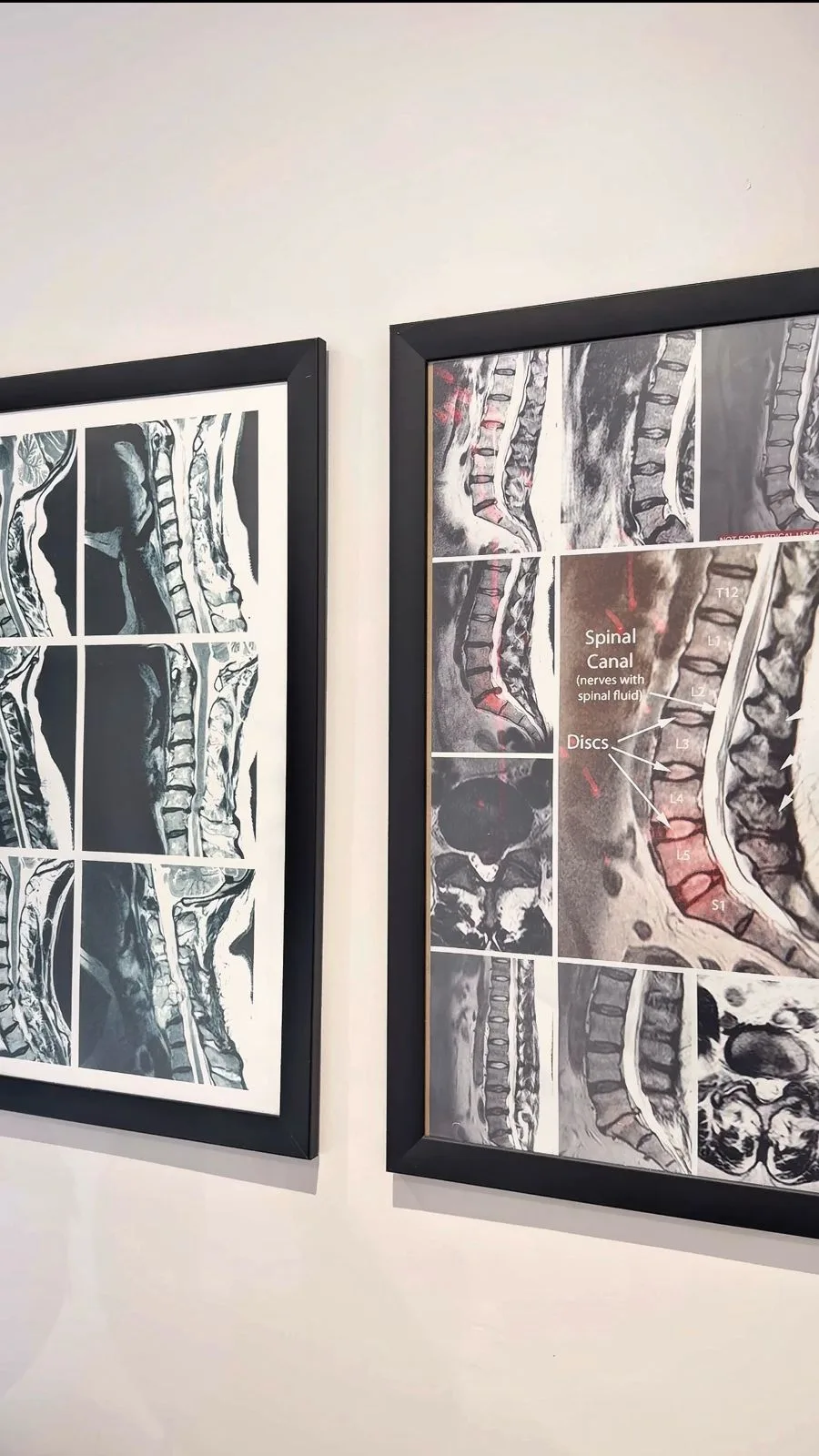 Spine Plus Gidea Park Interior 2