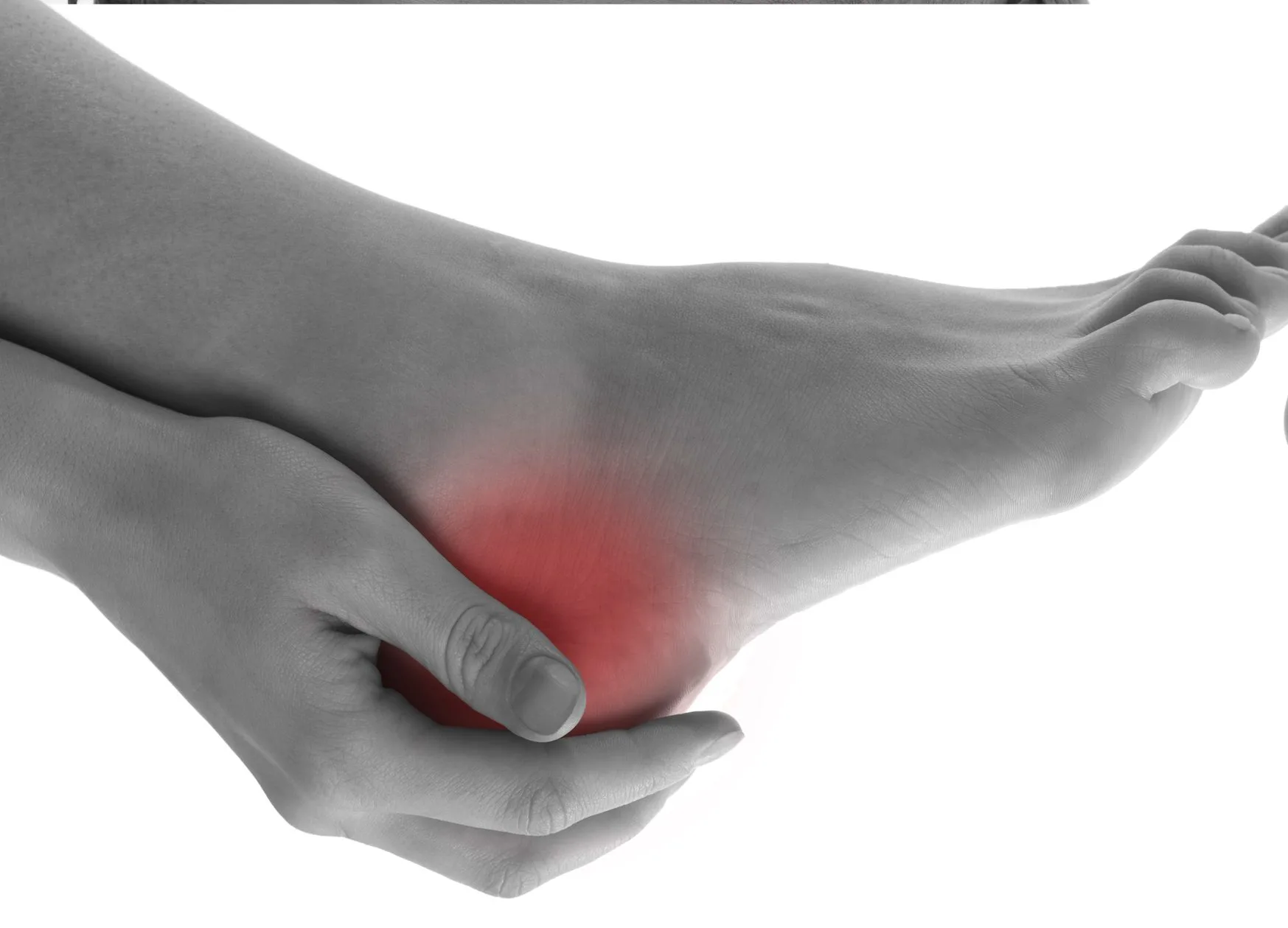 Heel pain plantar fasciitis