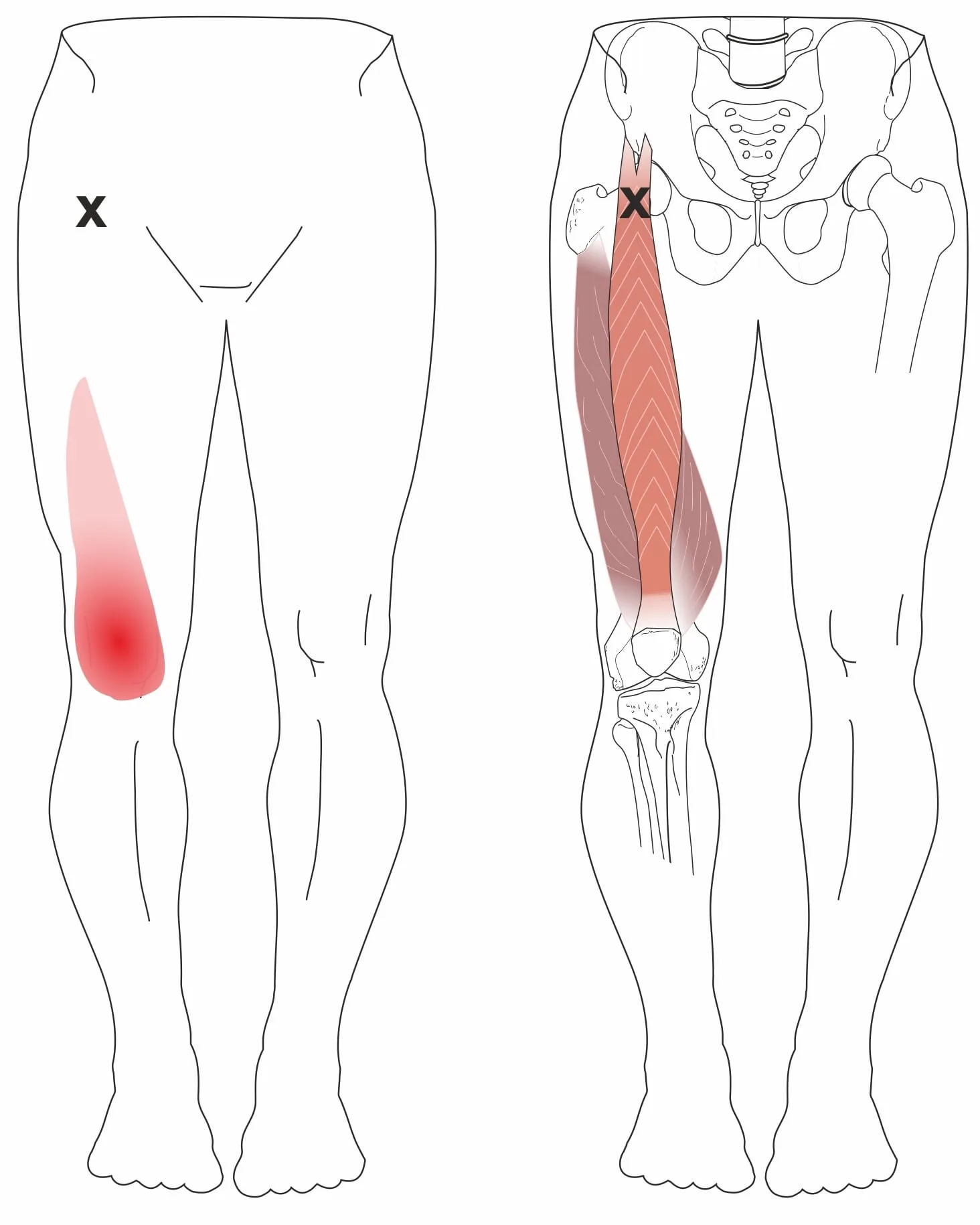 Knee pain cartilage treatment