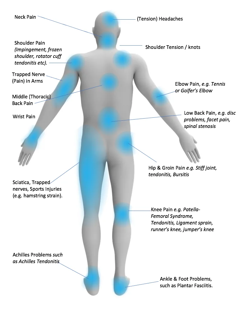 Body pain diagram showing common musculoskeletal conditions