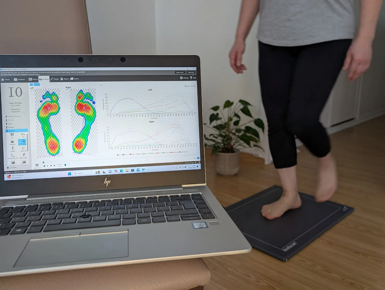 Foot Gait Scanner (Gait and Motion) at Spine Plus Woodford