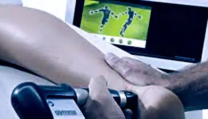 IDD therapy for sciatica