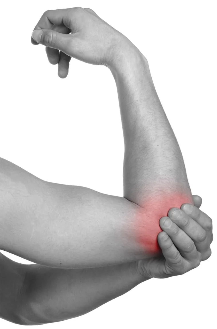 Lateral epicondylitis tennis elbow