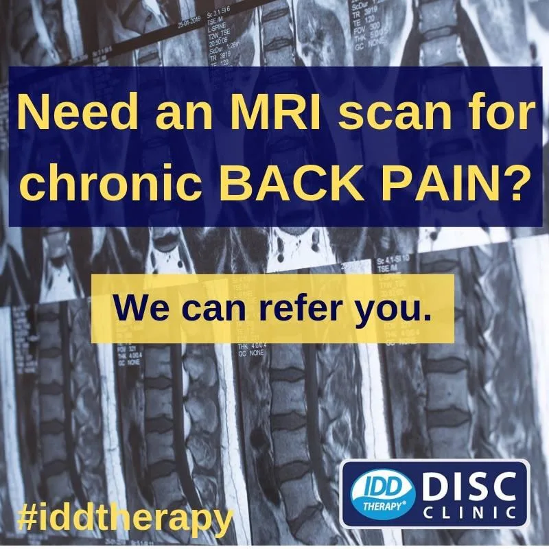 Need an MRI scan