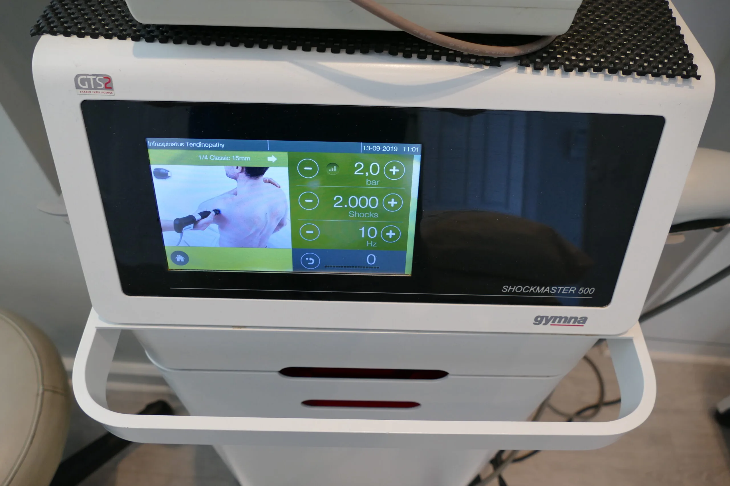 Radial Shockwave Therapy