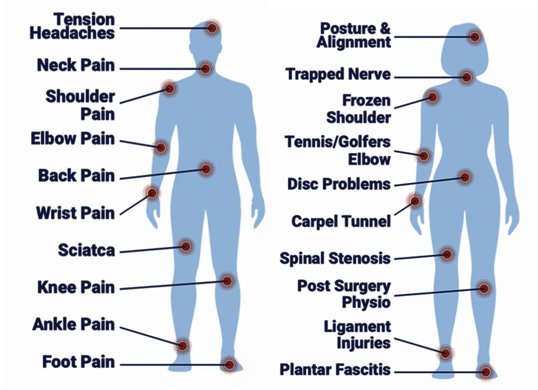 Conditions treated by physiotherapists